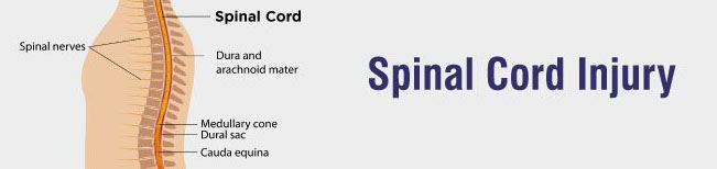Spinal Cord Injury